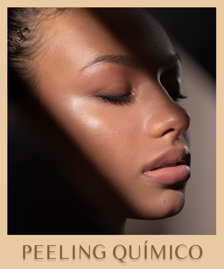 cad-nome-laser-peeling-quimico