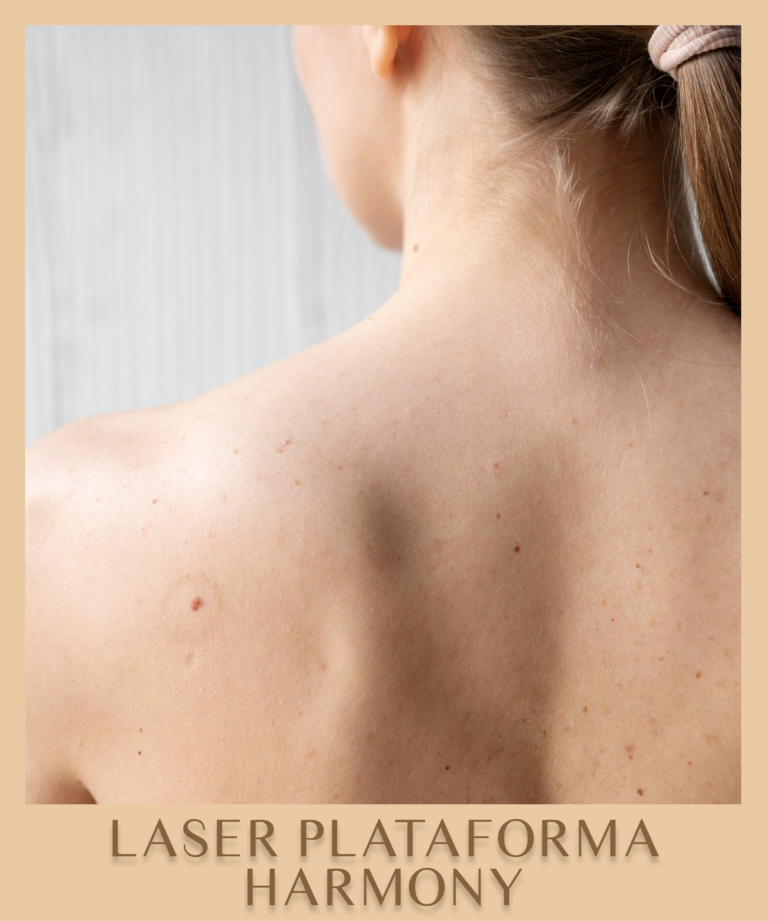 cad-nome-laser-plataforma-harmony