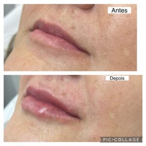 WhatsApp Image 2026-01-15 at 20.30.22