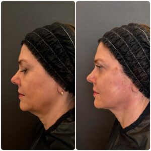 WhatsApp Image 2026-01-15 at 20.31.46